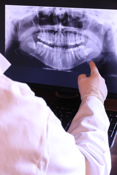 Best Emergency Denture Repair in Gettysburg, PA